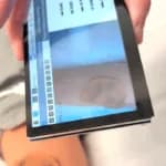 Raspberry Pi 3 clasifica lesiones de piel sin conexión