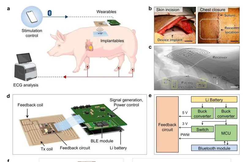 Estimulación cardíaca inalámbrica sin cables en un cerdo. Crédito: Nature Electronics (2026), https://doi.org/10.1038/s41928-026-01714-0